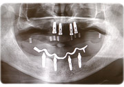 sec3_image